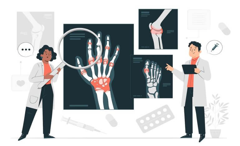 Arthritis Pain